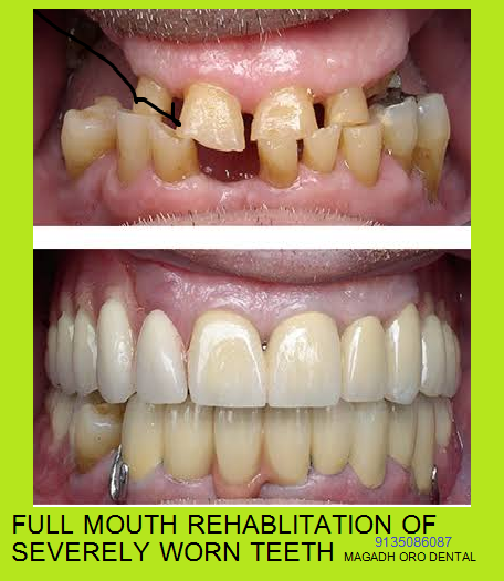 Magadh Oro Dental & Orthodontic Center Image 4