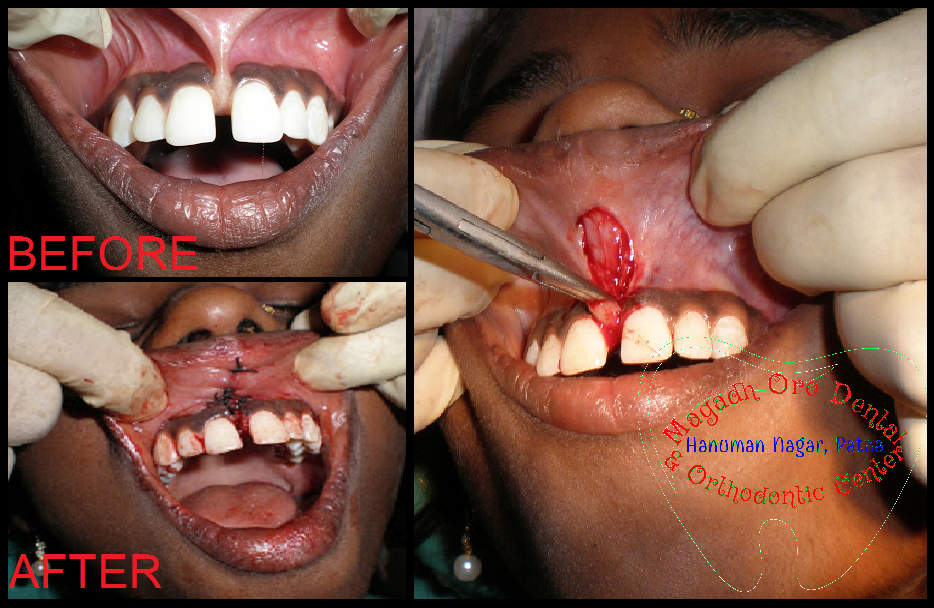 Magadh Oro Dental & Orthodontic Clinic Image 1
