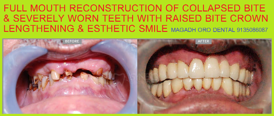 Magadh Oro Dental & Orthodontic Center Image 9