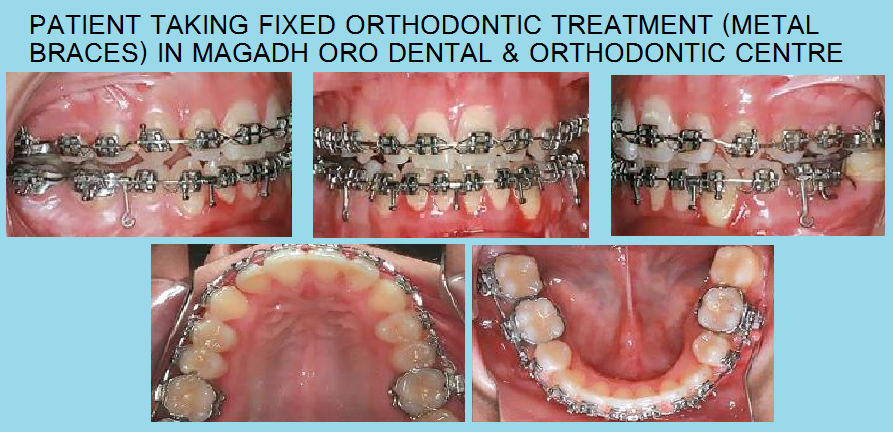 Magadh Oro Dental & Orthodontic Center Image 5