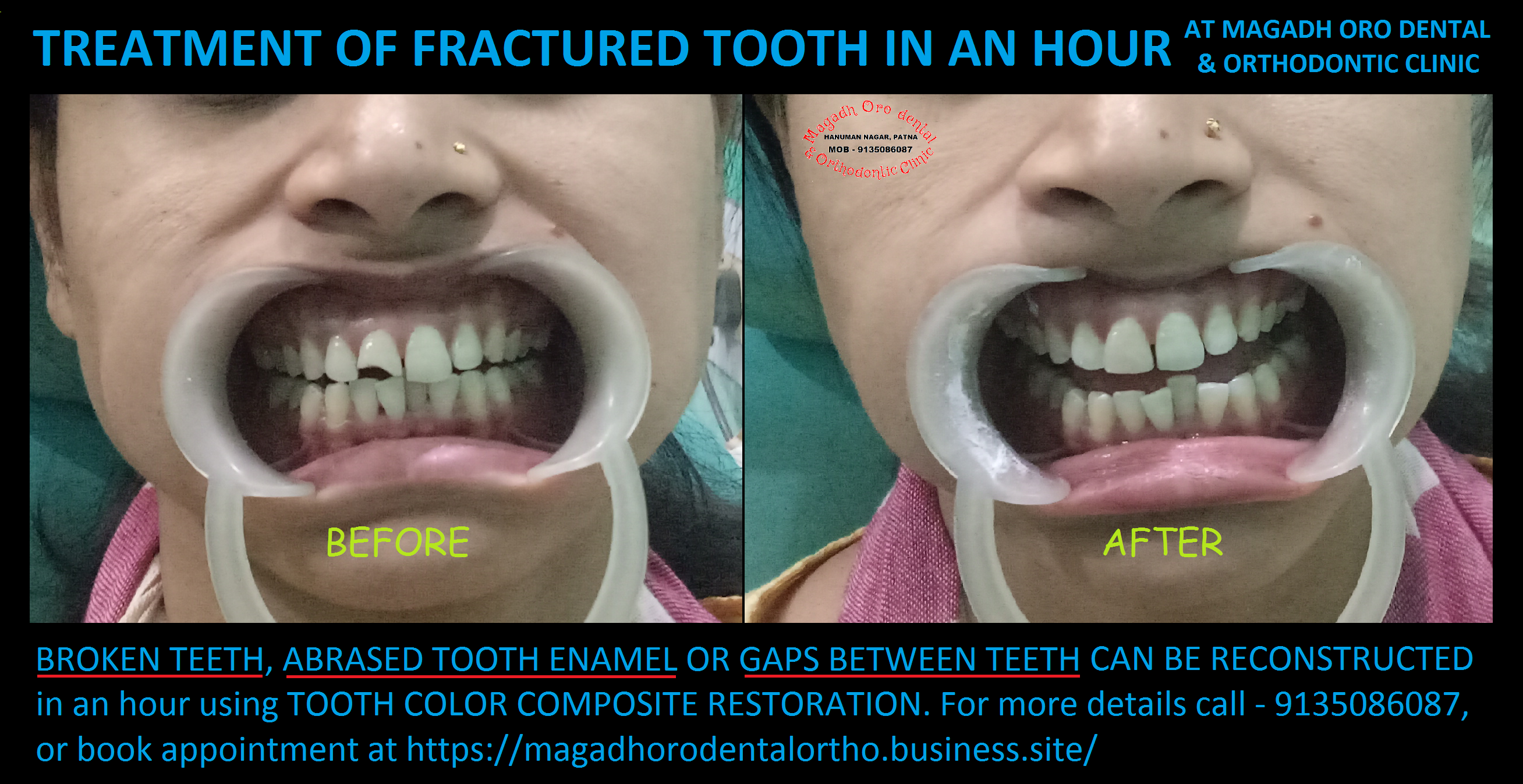 Magadh Oro Dental & Orthodontic Clinic Image 2