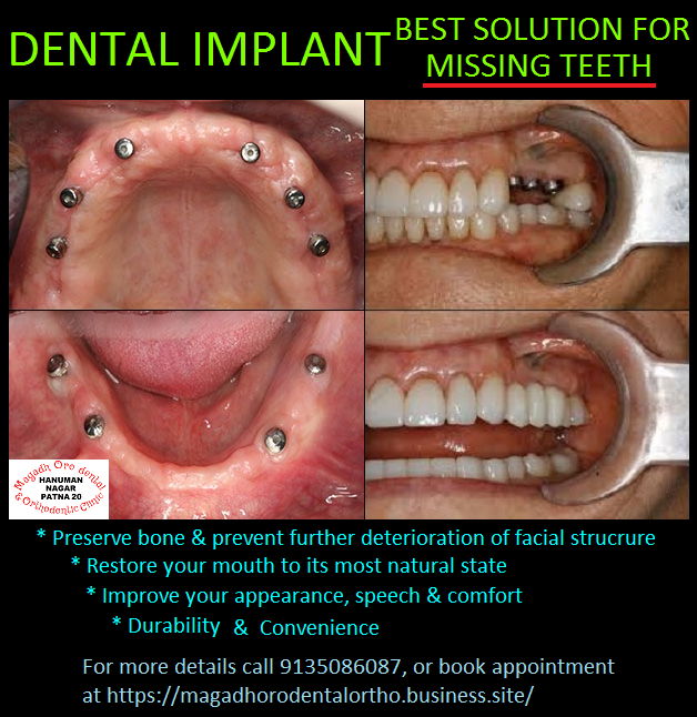 Magadh Oro Dental & Orthodontic Clinic Image 3