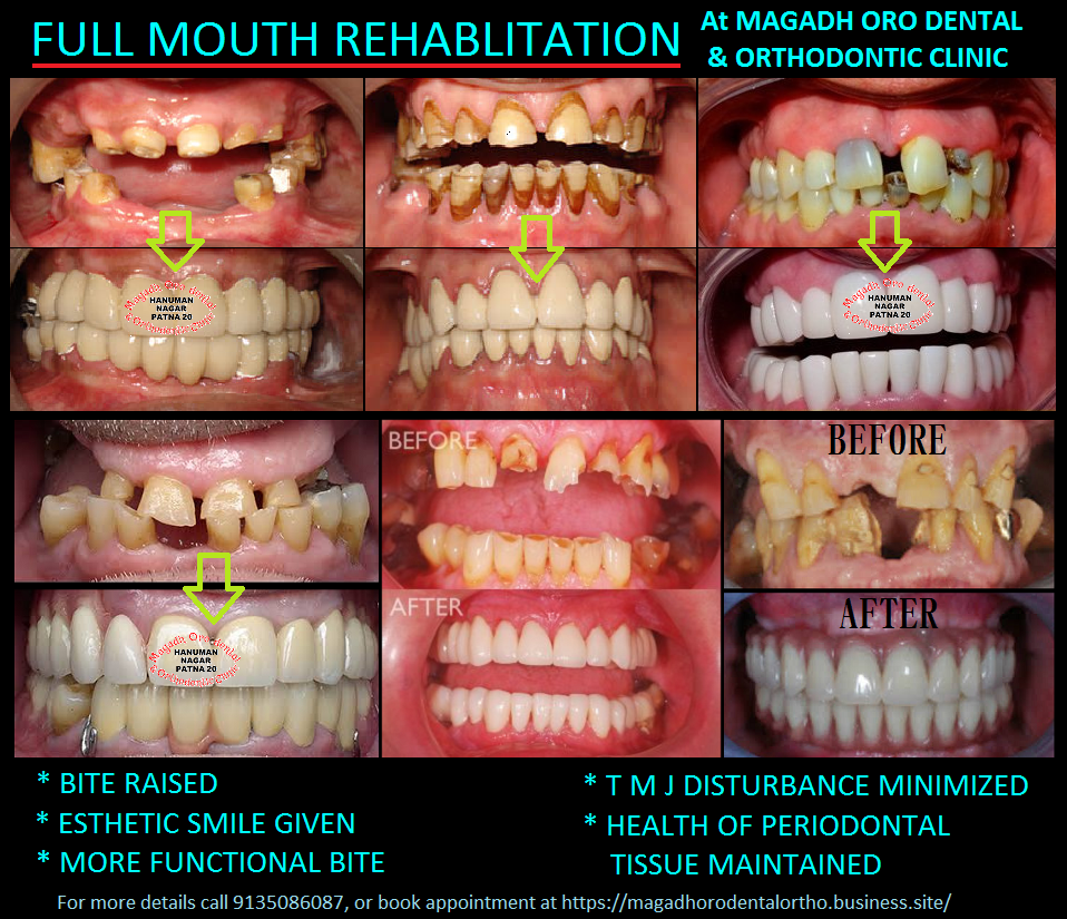 Magadh Oro Dental & Orthodontic Clinic Image 6