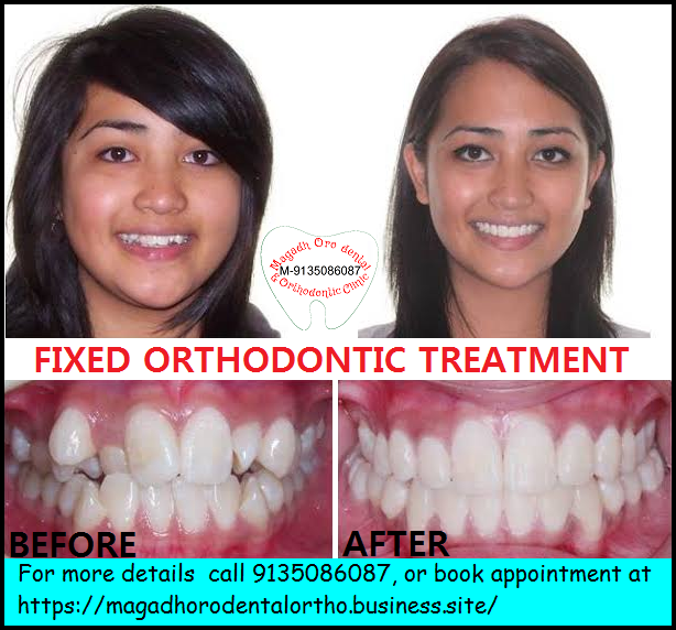 Magadh Oro Dental & Orthodontic Clinic Image 9