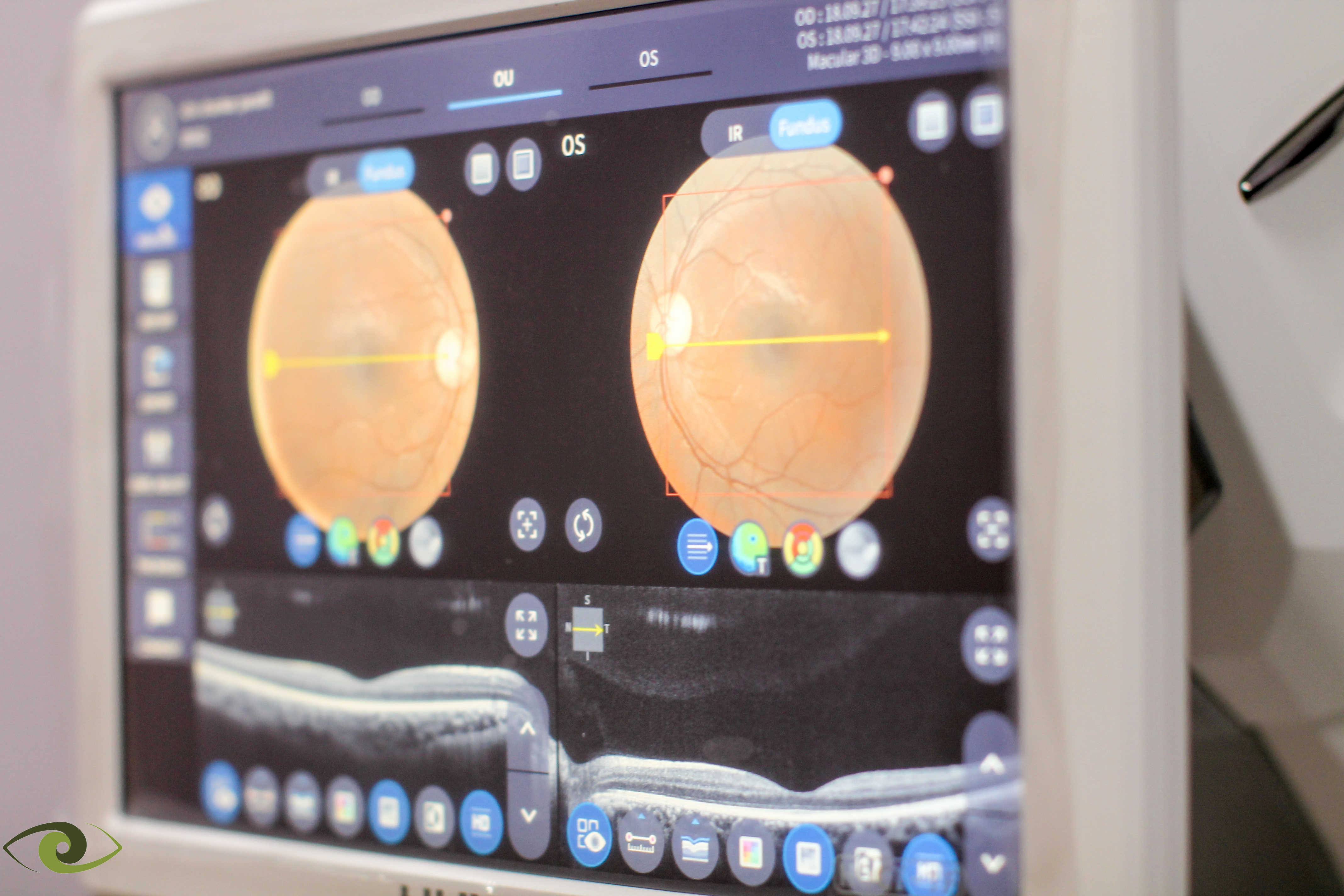 Elite Eyecare - By AIIMS Alumni, Mahagun Image 8