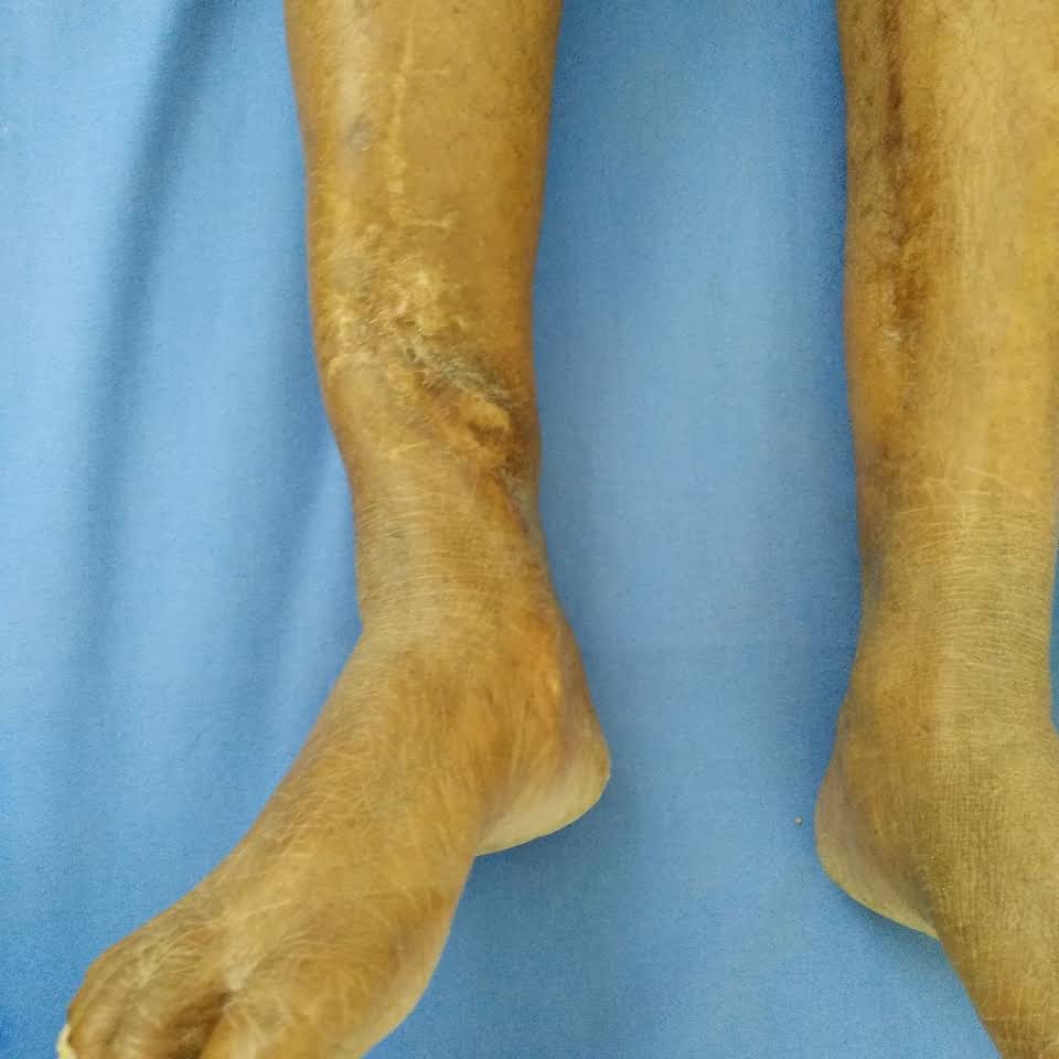 Sai Chandra Bone and Joint Clinic Image 1