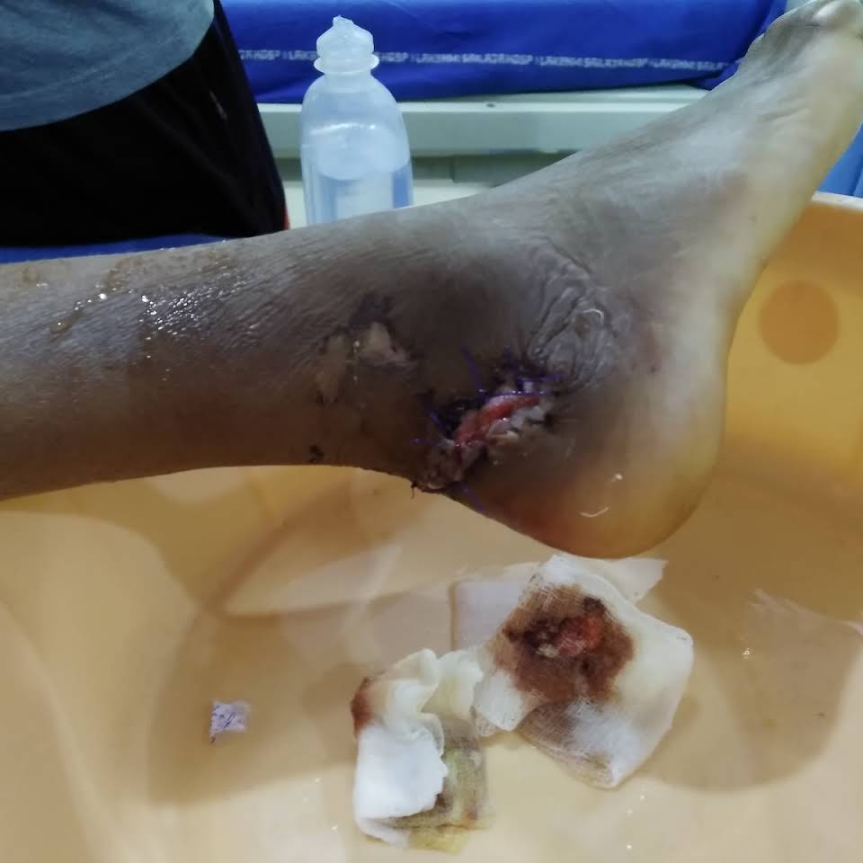 Sai Chandra Bone and Joint Clinic Image 4