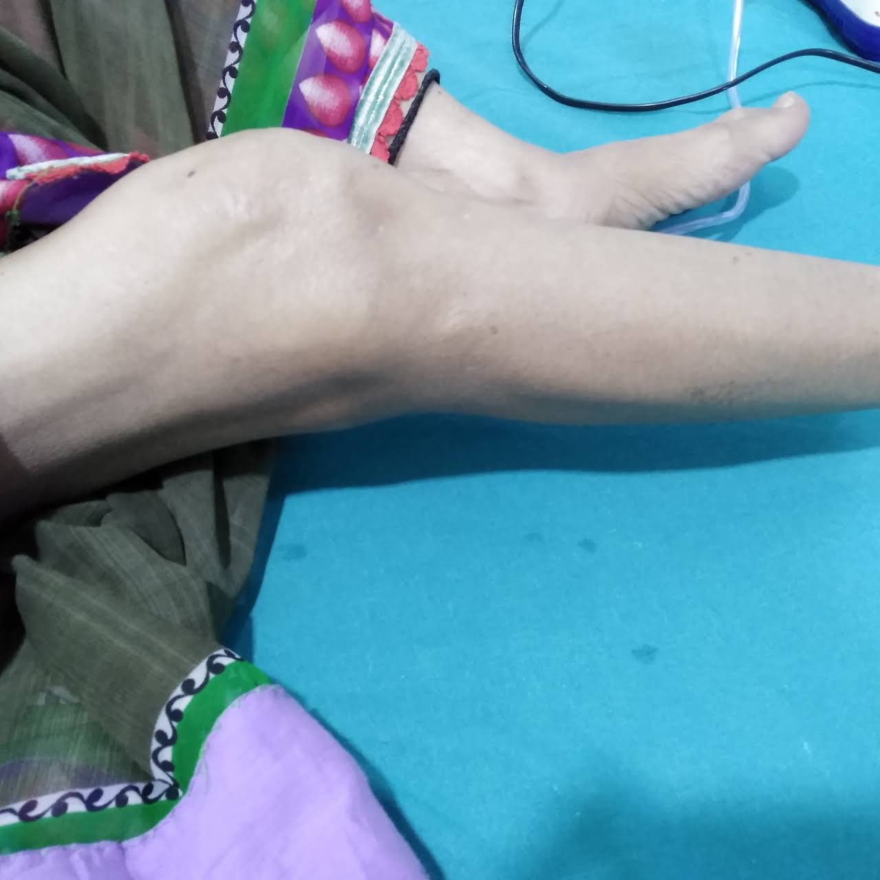 Sai Chandra Bone and Joint Clinic Image 3