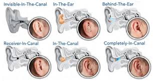 Dr ABHISHEK HEARING AID CENTRE KANPUR Image 8