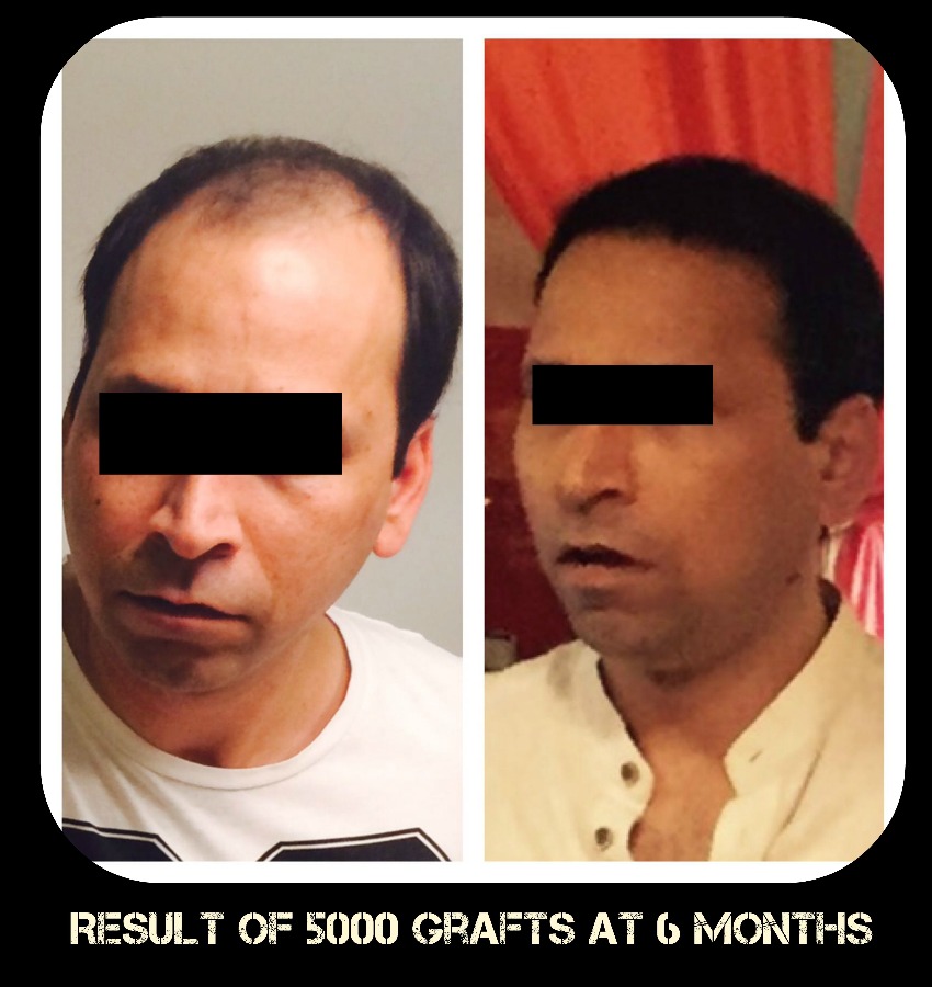 Delight Clinic - Hair Transplant,Laser & Cosmetic Surgery Centre Image 3