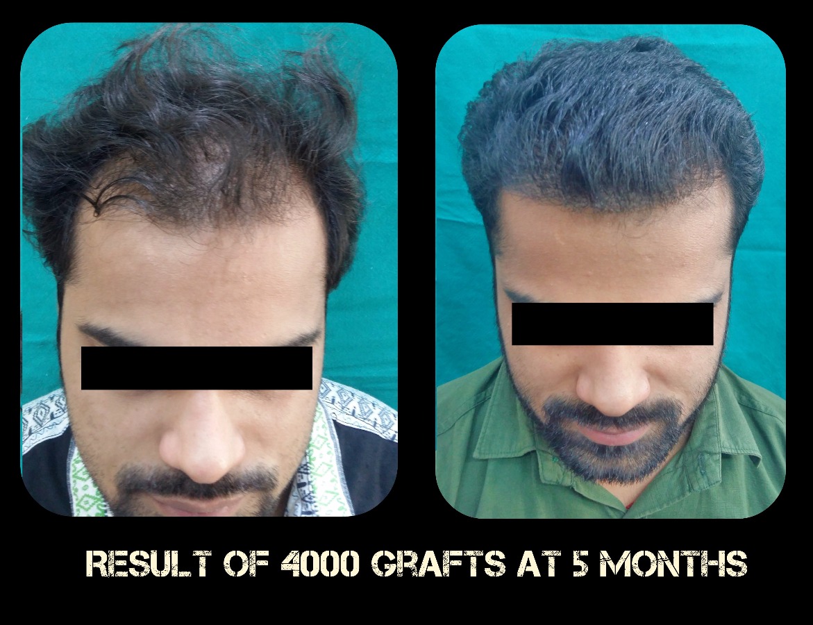 Delight Clinic - Hair Transplant,Laser & Cosmetic Surgery Centre Image 2