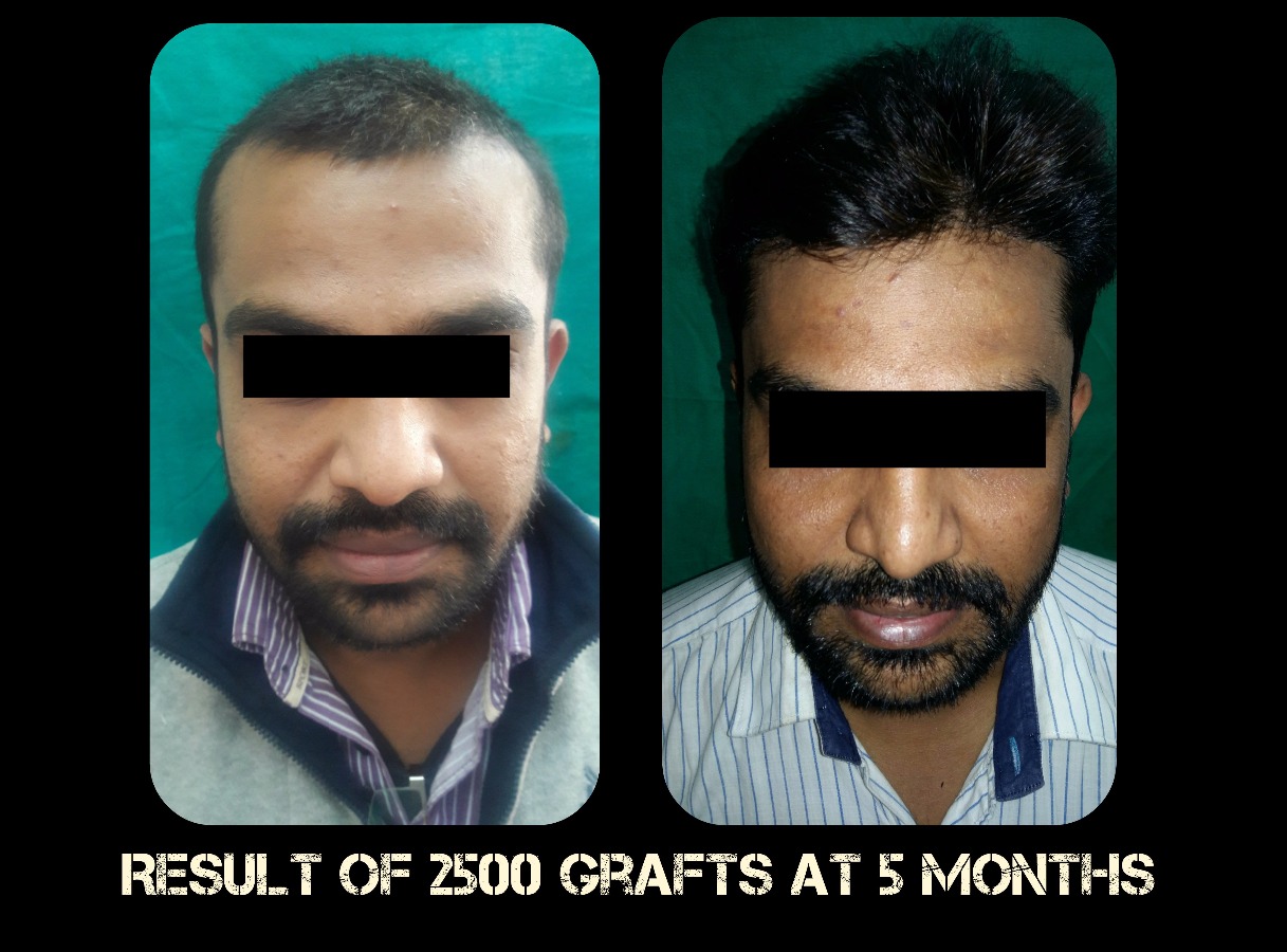 Delight Clinic - Hair Transplant,Laser & Cosmetic Surgery Centre Image 4
