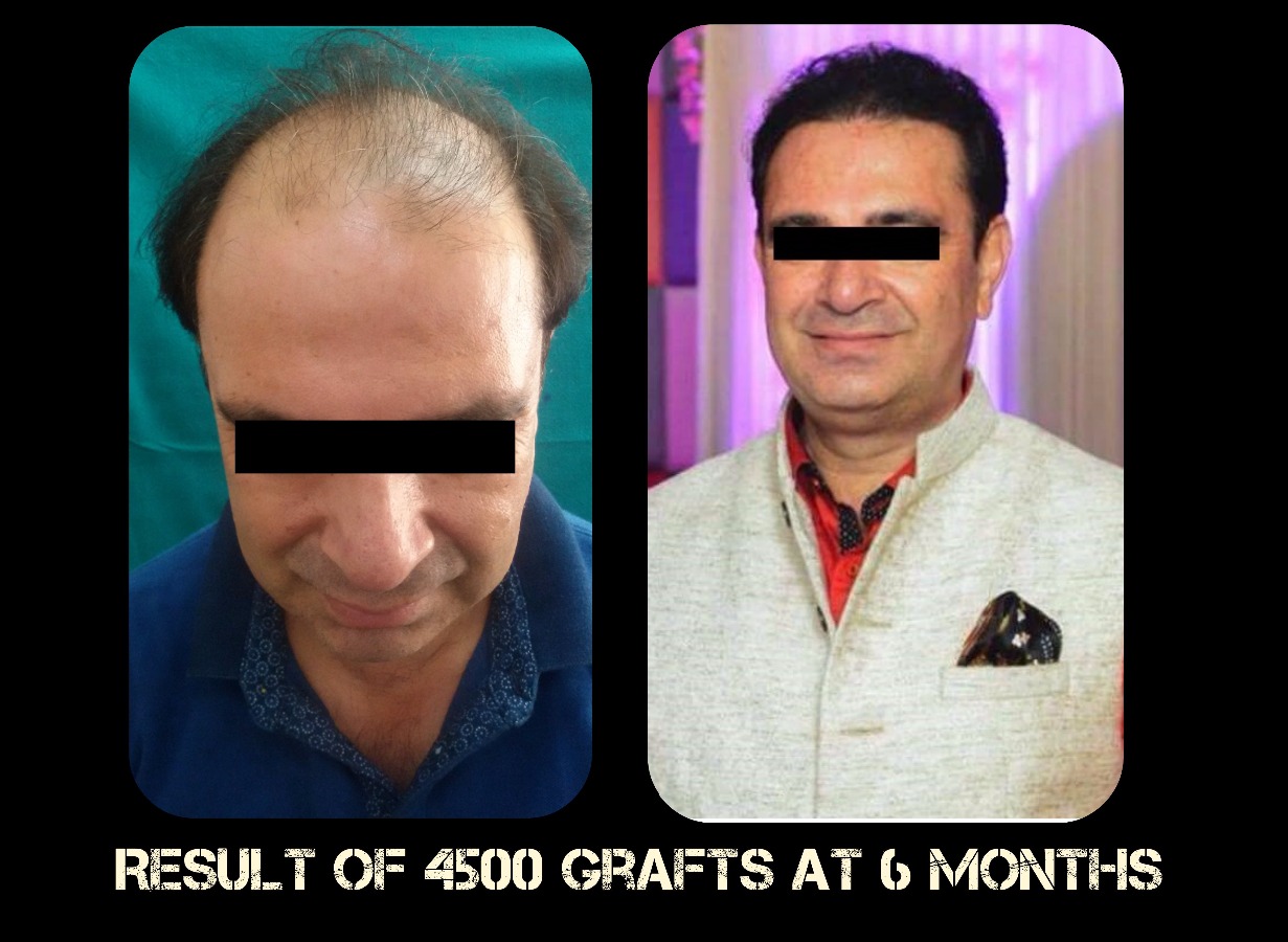 Delight Clinic - Hair Transplant,Laser & Cosmetic Surgery Centre Image 5