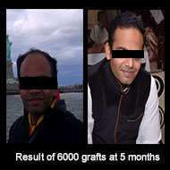 Delight Clinic - Hair Transplant,Laser & Cosmetic Surgery Centre Image 6