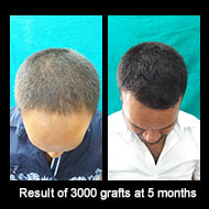 Delight Clinic - Hair Transplant,Laser & Cosmetic Surgery Centre Image 7