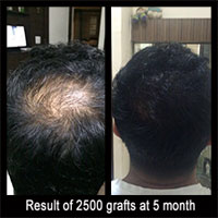 Delight Clinic - Hair Transplant,Laser & Cosmetic Surgery Centre Image 1