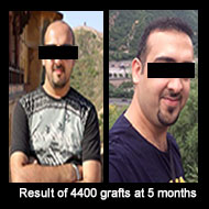 Delight Clinic - Hair Transplant,Laser & Cosmetic Surgery Centre Image 8