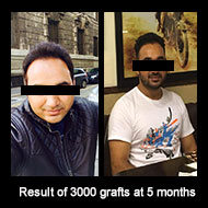 Delight Clinic - Hair Transplant,Laser & Cosmetic Surgery Centre Image 9