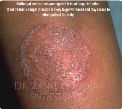 Zafeerah Skin Clinic Image 1