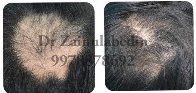 Zafeerah Skin Clinic Image 4