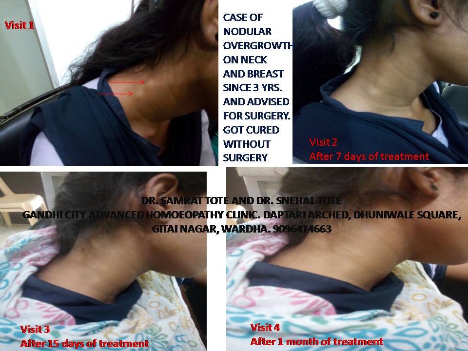 Gandhi City Advanced Homoeopathy Clinic Image 2