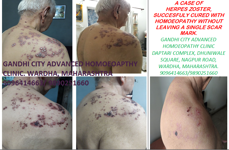 Gandhi City Advanced Homoeopathy Clinic Image 3