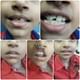 NEELAM DENTAL CARE Image 4