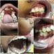 NEELAM DENTAL CARE Image 1