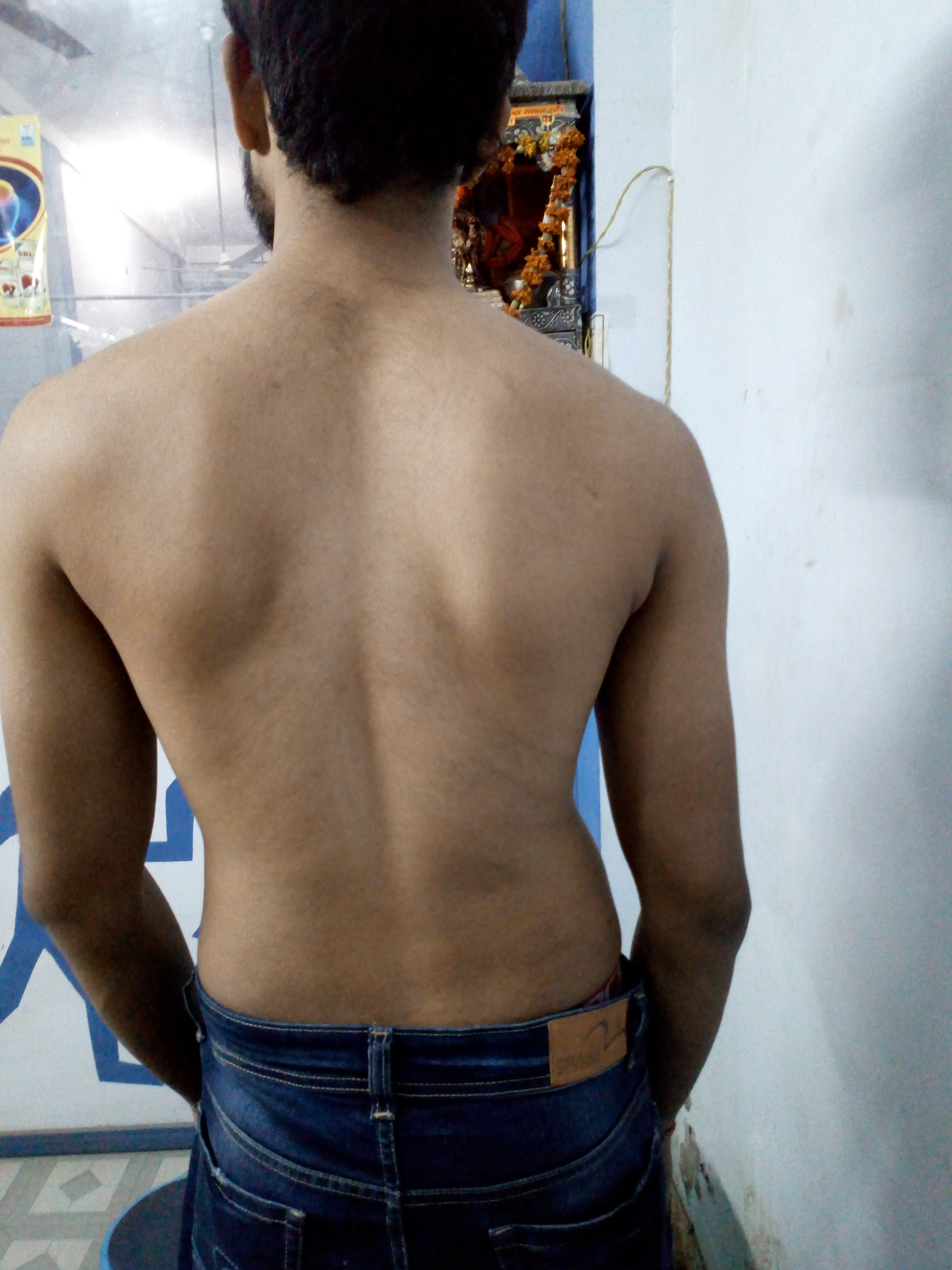 Sbi physiotherapy & homeopathic hospital Image 1