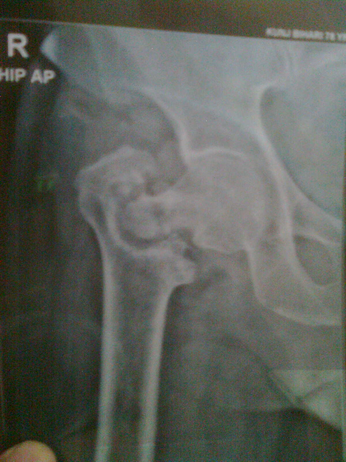 Ahsaas physiotherapy clinic Image 1