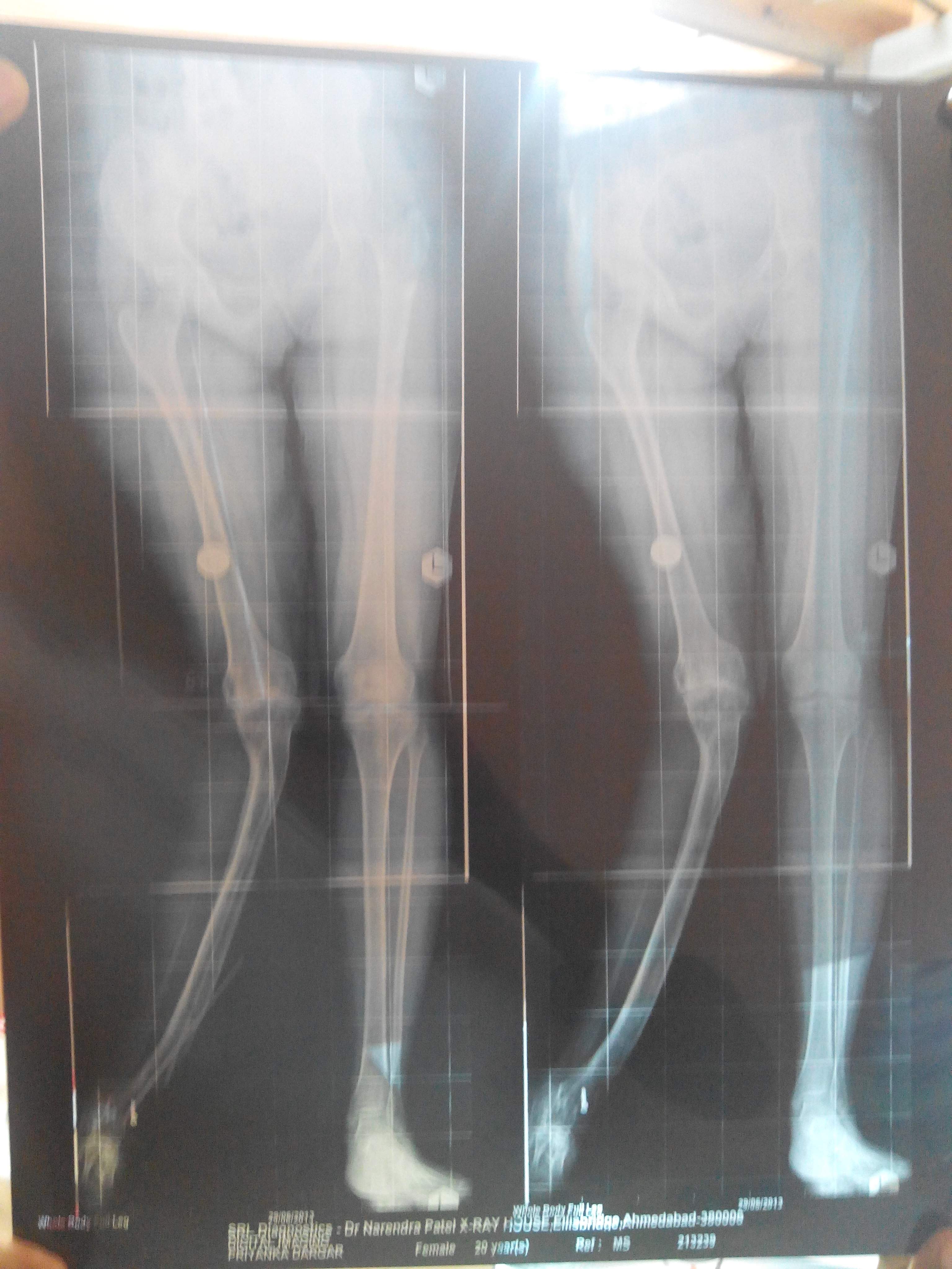 Ahsaas physiotherapy clinic Image 3