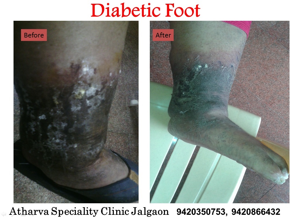Dr. Anupam Dandgavhal At Thane Image 7