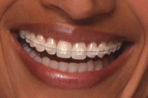 Smile Isle Dental Care Image 7
