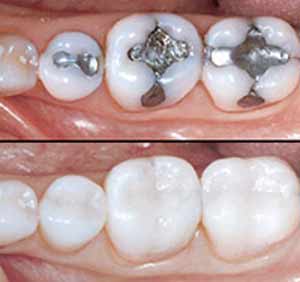 Smile Isle Dental Care Image 9