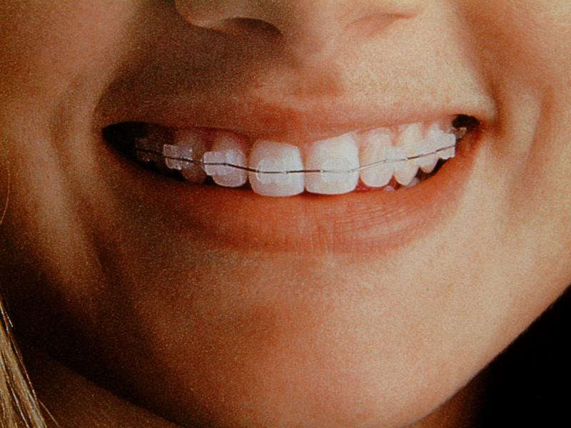 Smile Isle Dental Care Image 8