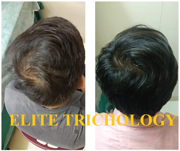 Elite Trichology Image 7