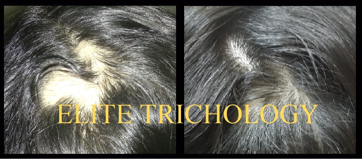 Elite Trichology Image 6