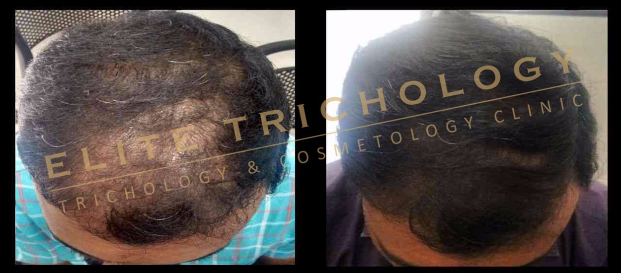 Elite Trichology Image 4
