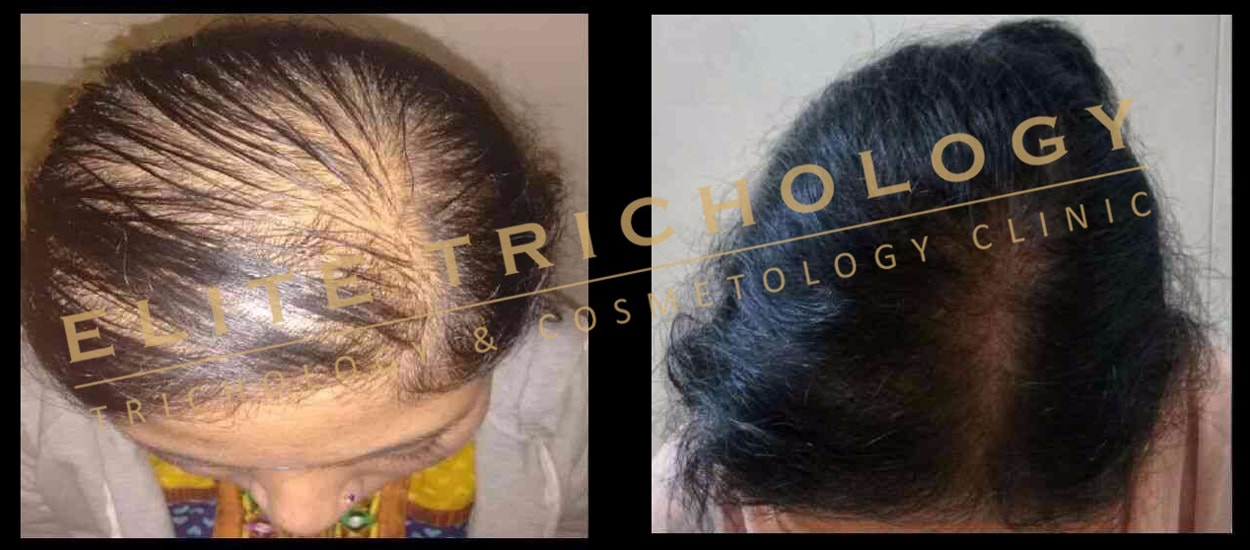 Elite Trichology Image 8