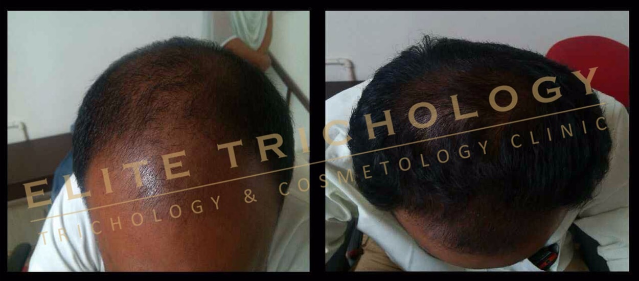 Elite Trichology Image 2