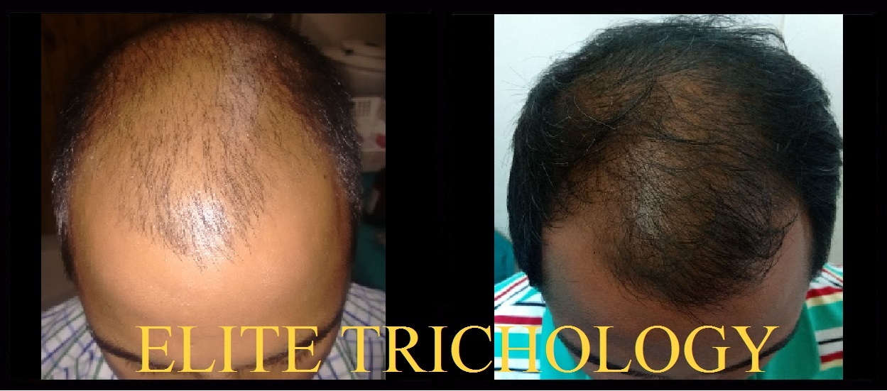 Elite Trichology Image 5
