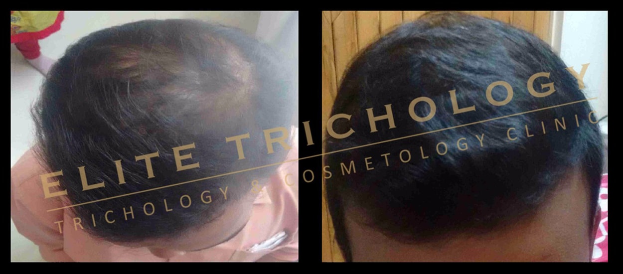 Elite Trichology Image 3