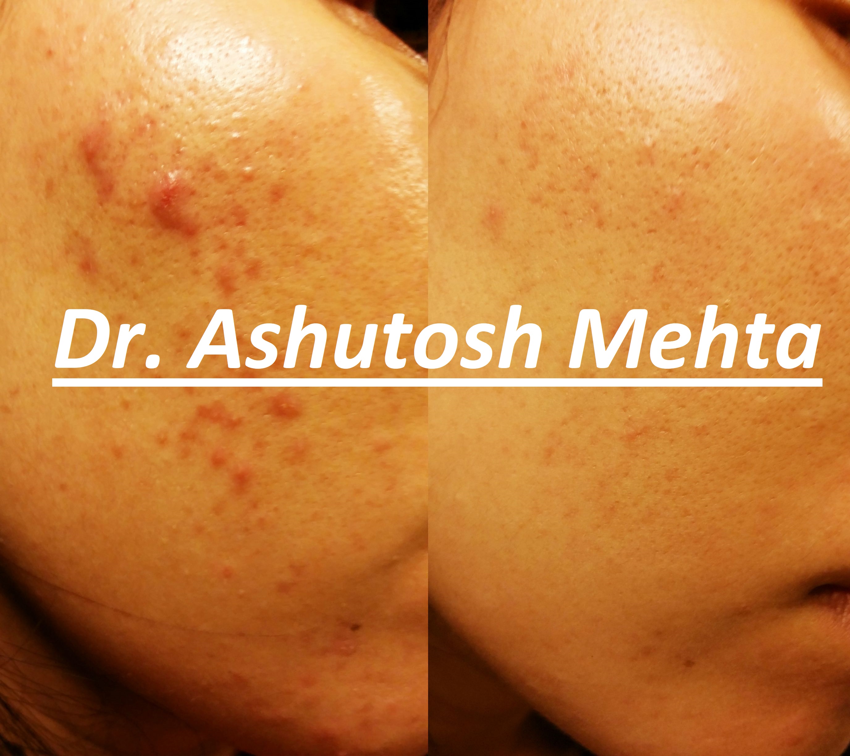 Dr. Mehta's Skin Clinic Image 1
