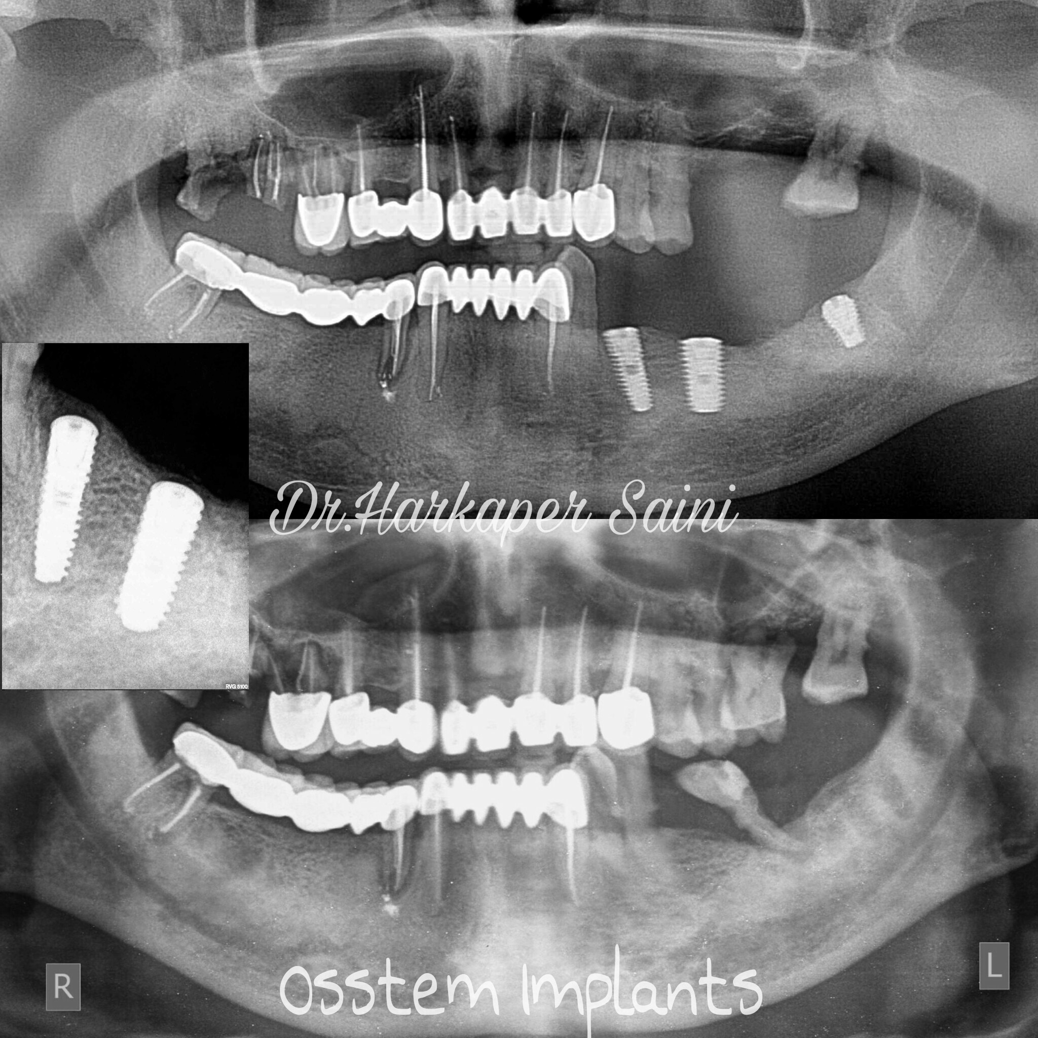 Dr. Saini's Dental Studio Image 5