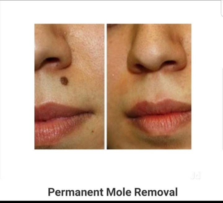 Lal Skin Care Image 7