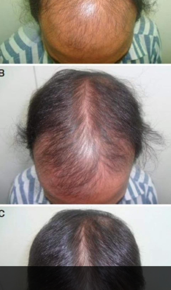 Lal Skin Care Image 10