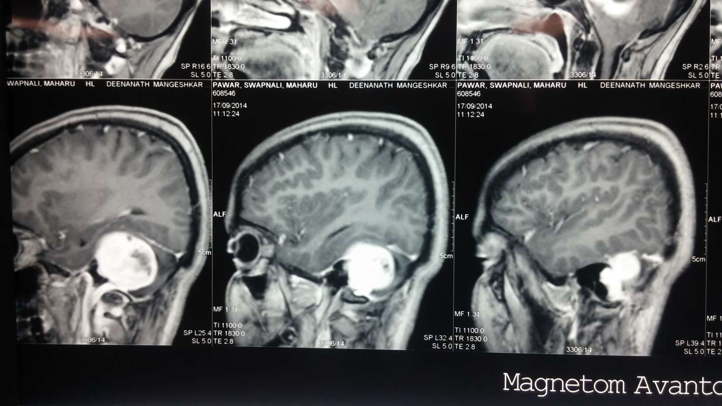 Dr.Kaustubh Dindorkar's Brain & Spine Surgery Clinic Image 1