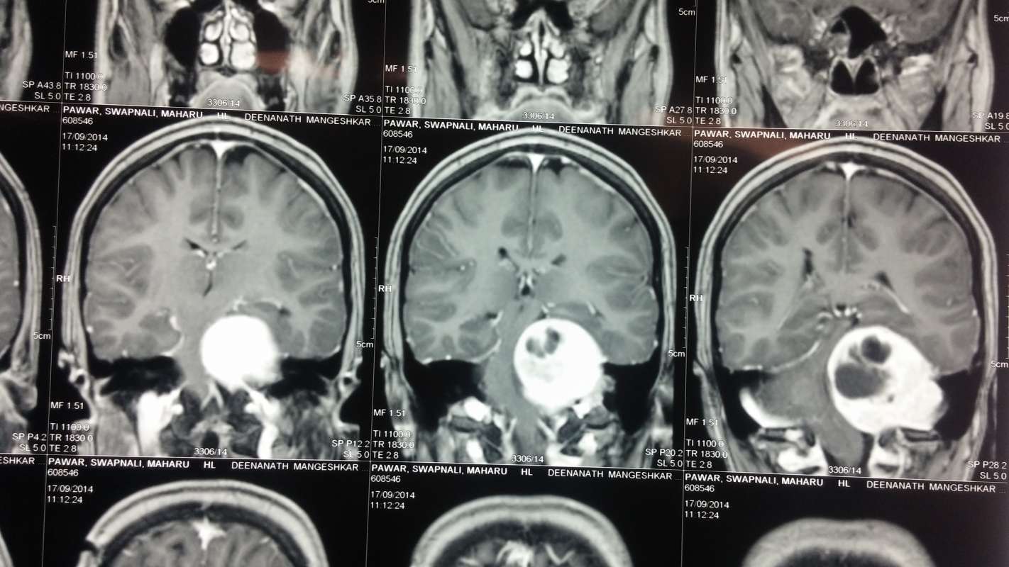 Dr.Kaustubh Dindorkar's Brain & Spine Surgery Clinic Image 2