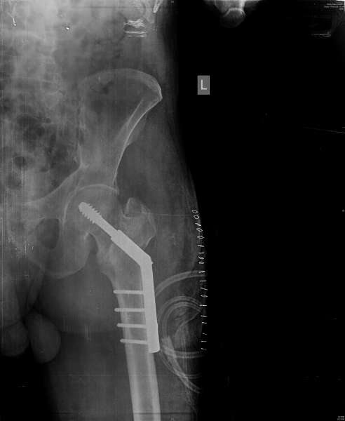 ORTHOPEDIC CLINIC- MAGNA CLINICS Image 2