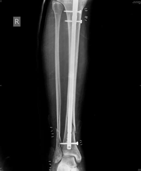 ORTHOPEDIC CLINIC- MAGNA CLINICS Image 5